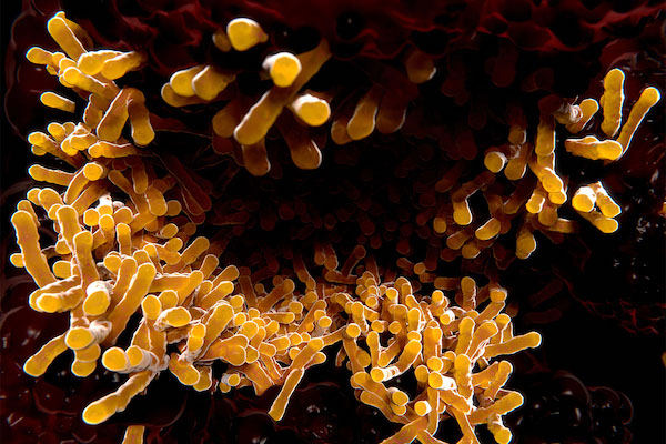 Tuberculosis Bacterium